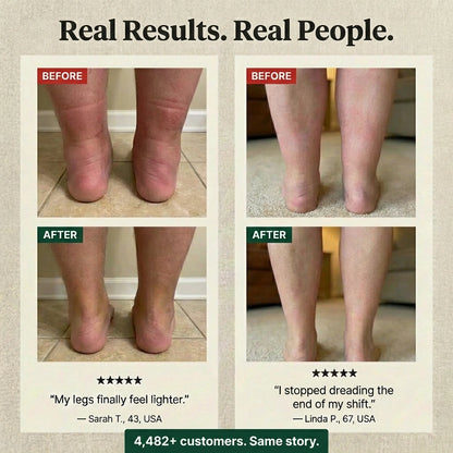 Lighter legs. Less puffiness. One drop every morning.