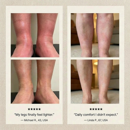 Lymphatic Support Drops - Lymphlite