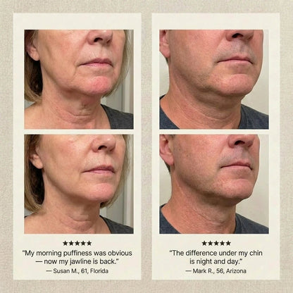 Lymphlite Face Reset Formula - Lymphlite